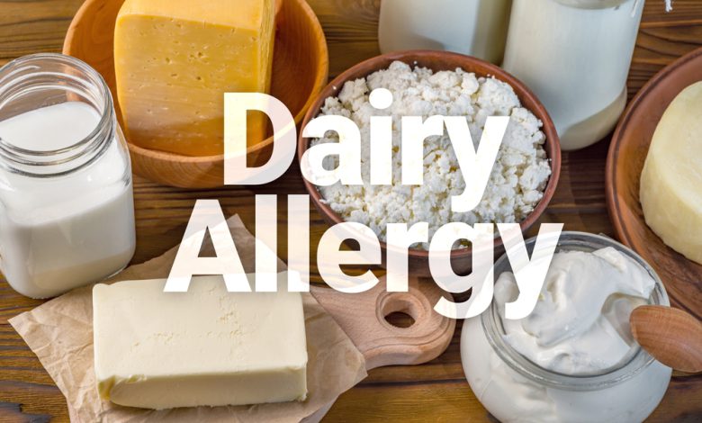 علاج حساسية الحليب عند الرضع